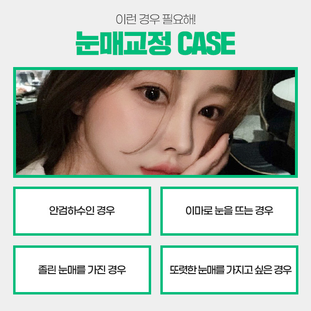 여자무쌍눈매교정 기대해도 좋아 관련 이미지 3