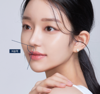 Q. 비순각성형이랑 비주성형이 정확히 뭔가요? 같은 말인걸까요? 관련 이미지 1