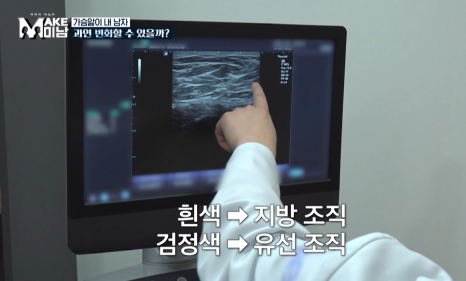[에이비성형외과 방송출연] LG헬로비전&KBSjoy 관련 이미지 18