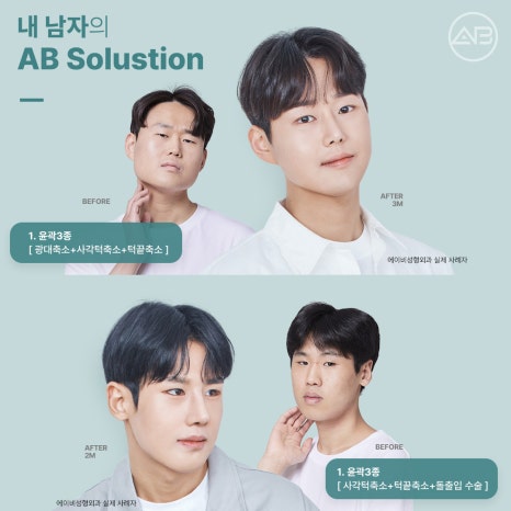 자려한안면윤곽 원한다면 AB성형외과 관련 이미지 13