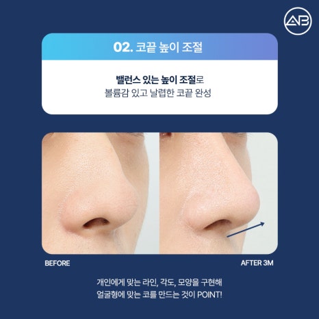 AB Plastic Surgery: What’s Different About an Elegant Male Straight Nose Surgery? image 6