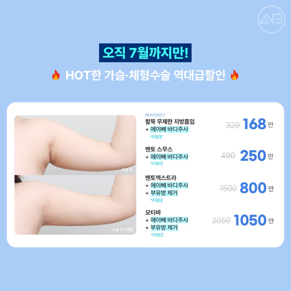 에이비성형외과 6월7월 여름 할인 이벤트 관련 이미지 3