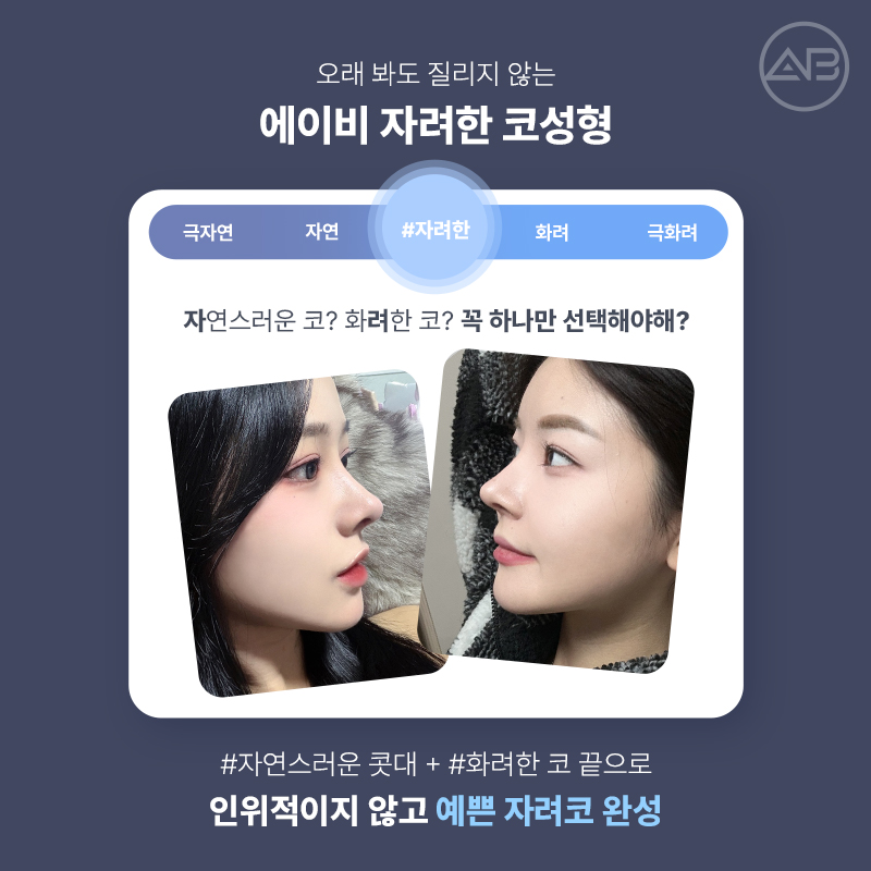 에이비성형외과 자려한코성형 비주라인개선 후기 관련 이미지 2