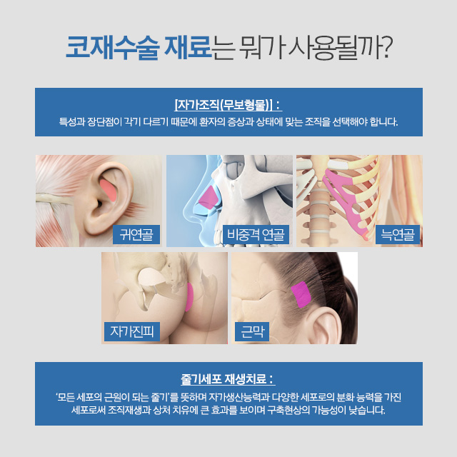 코재수술비용 고민이라면 AB성형외과에서 알아봐 관련 이미지 5