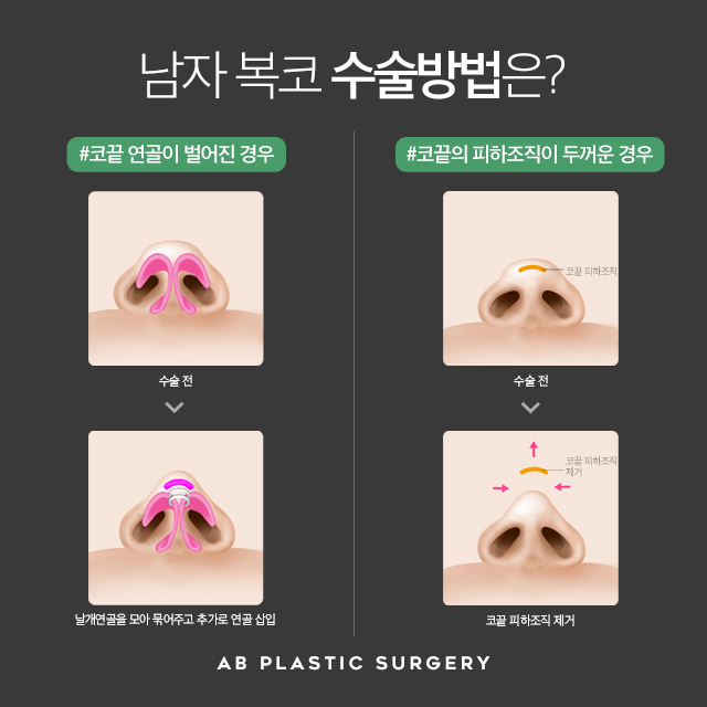 남자코성형 에이비와 함께라면 자신감 UP 관련 이미지 6