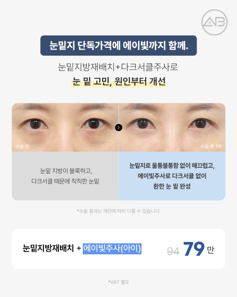 에이비성형외과 추석 기획전 눈밑, 비중격첫코, 윤곽 이벤트 관련 이미지 2
