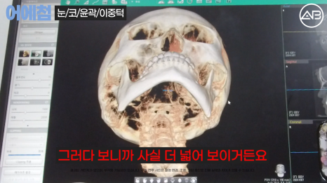 에이비성형외과 관련 이미지 4