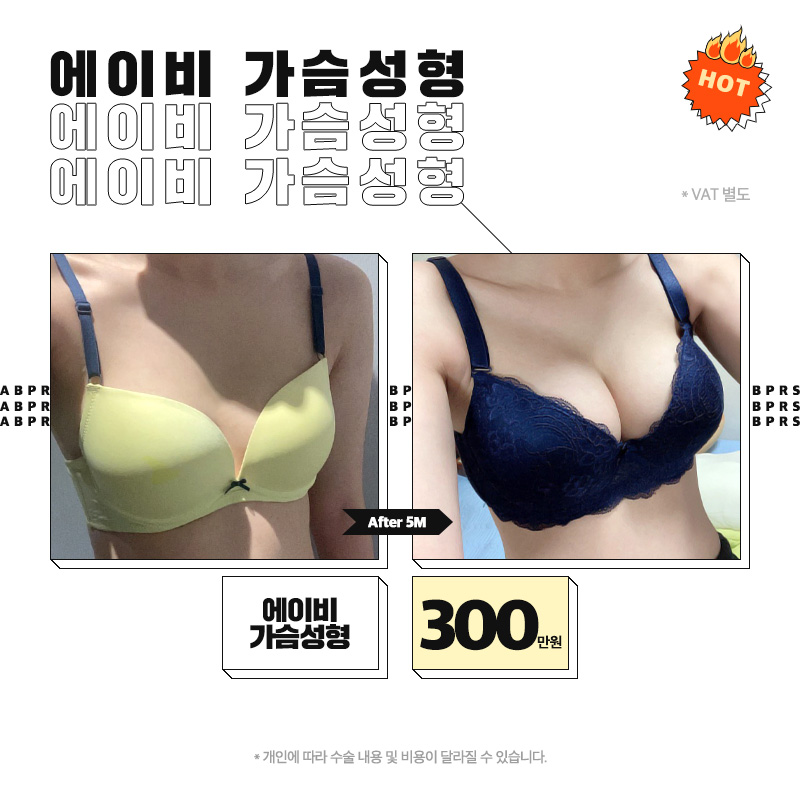 에이비성형외과 확장이전 이벤트 안내 관련 이미지 5