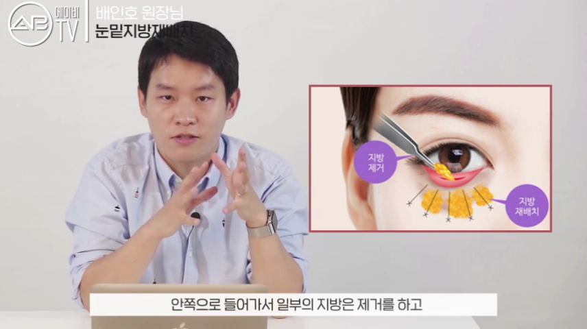 에이비성형외과 #유튜브 #에이비TV #눈수술 #눈밑지방재배치 관련 이미지 4