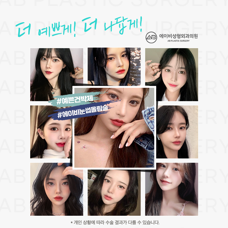 What Is the Endtop Eyebrow Lift That So Many People in Their 20s and 30s Are Getting? image 10