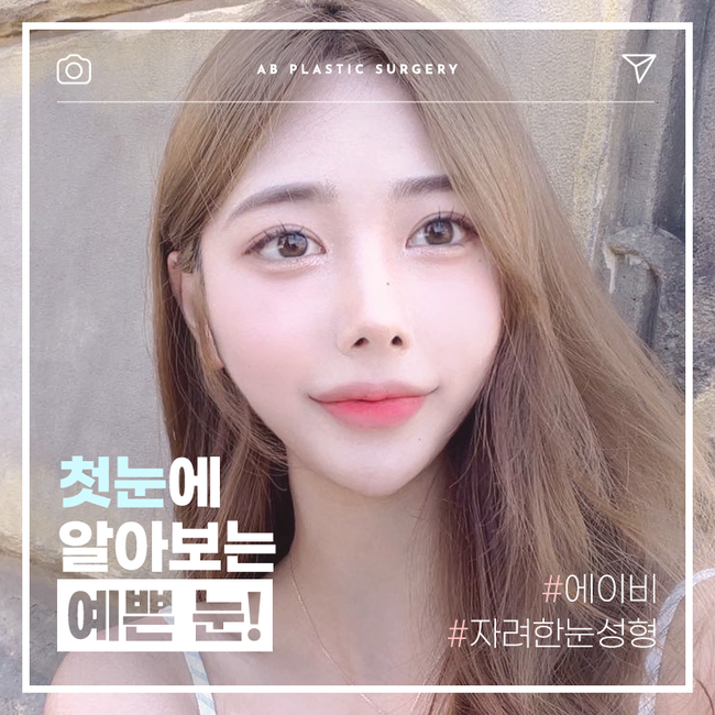 If You’re Looking for a Glamorous Double Eyelid Surgery, AB Plastic Surgery image 1