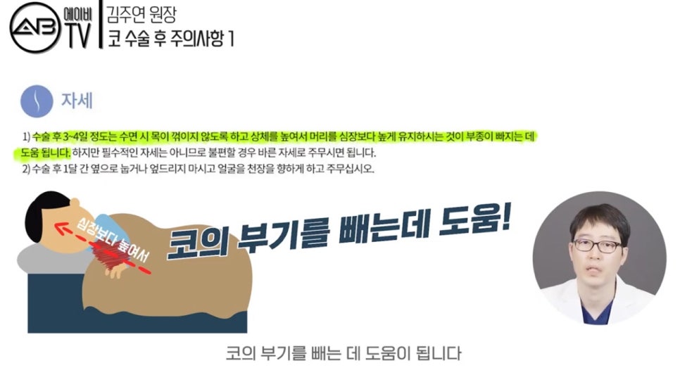 #에이비성형외과#에이비TV#코성형#주의사항1탄 관련 이미지 2