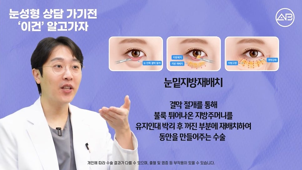 #AB Plastic Surgery #AB TV #Eye Surgery #Eye Surgery Terminology image 12