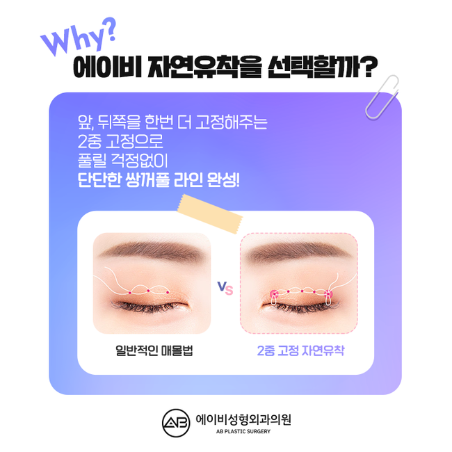 AB Plastic Surgery Natural Adhesion Review image 4