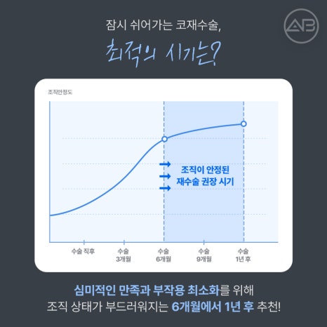 코재수술 필요하다면 에이비성형외과 관련 이미지 11