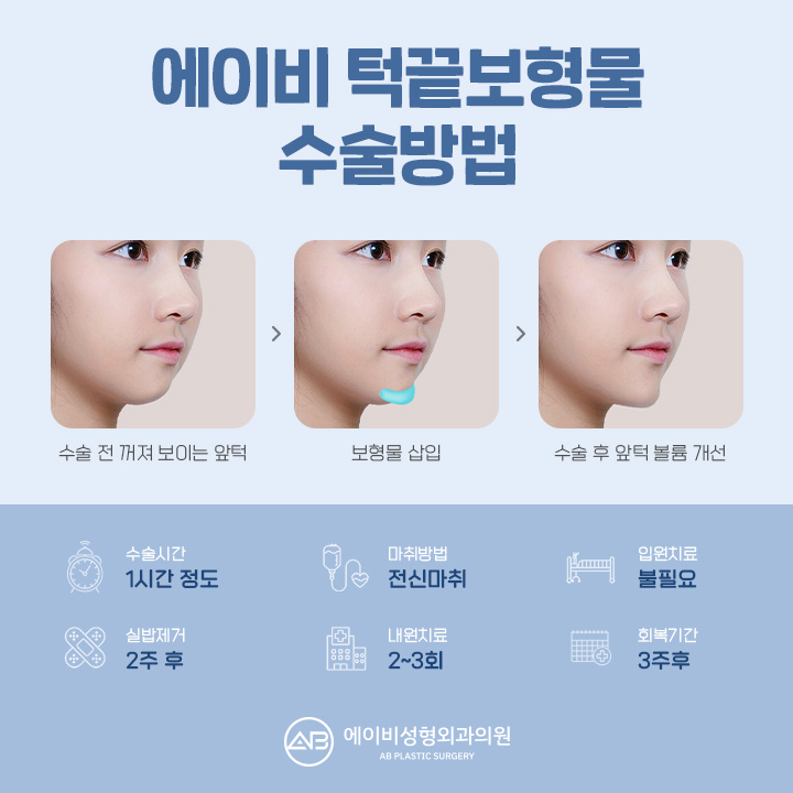 안면윤곽성형 두렵다면 보형물 윤곽성형은 어때 관련 이미지 3