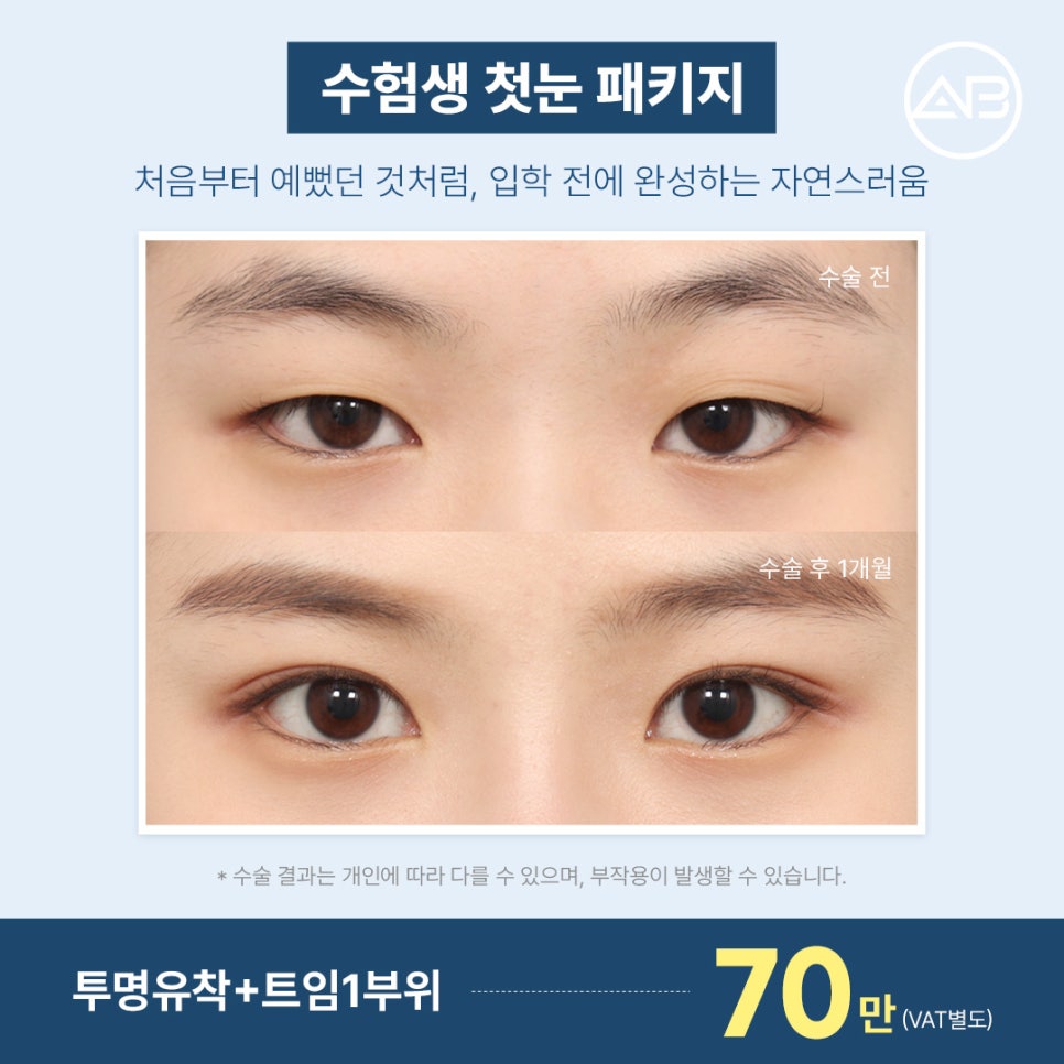 에이비성형외과 수능 끝! 2027 수험생 특별 이벤트 관련 이미지 3