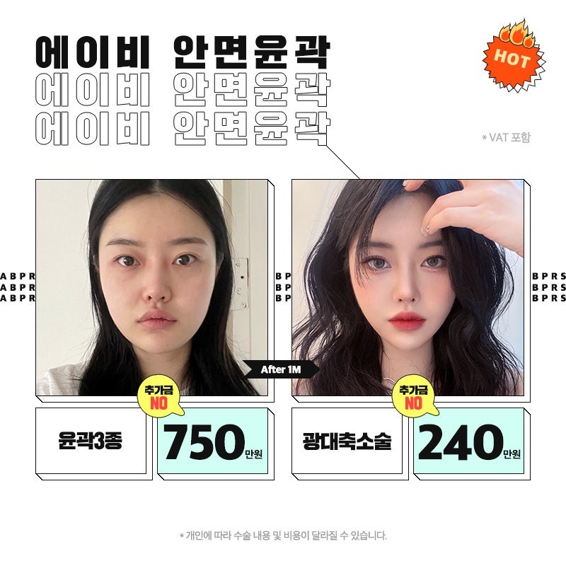 에이비성형외과 확장이전 이벤트 안내 관련 이미지 4