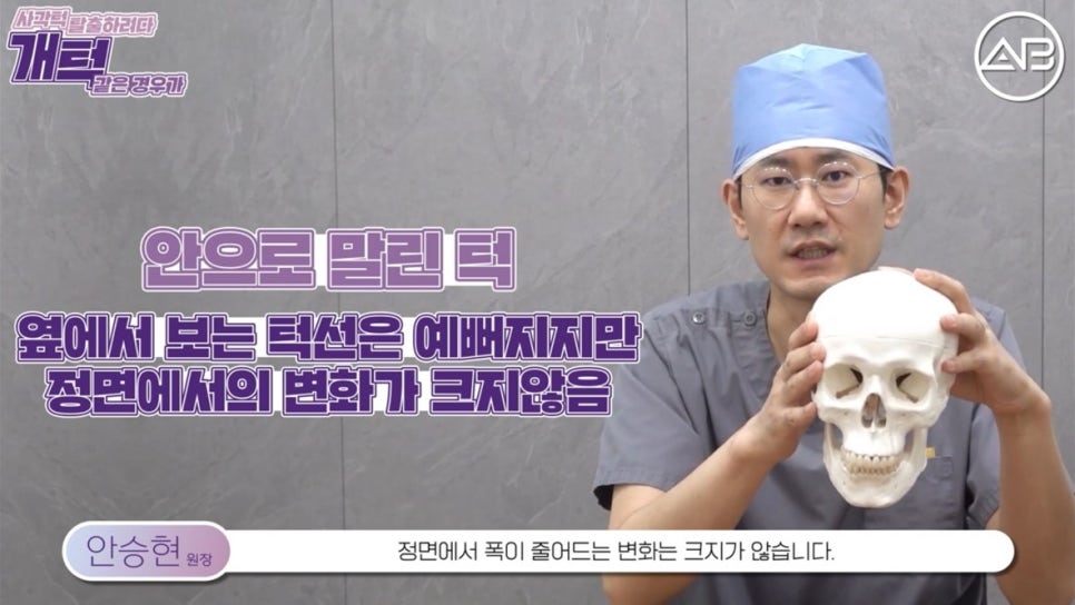#에이비성형외과#에이비tv#안면윤곽#사각턱 관련 이미지 7
