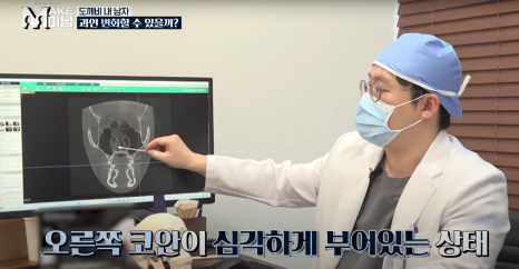 [에이비성형외과 방송출연] LG헬로비전&KBSjoy 관련 이미지 9