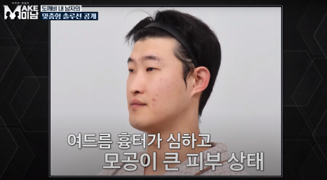 [에이비성형외과 방송출연] LG헬로비전&KBSjoy 관련 이미지 19