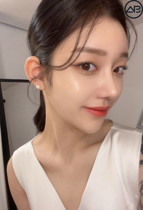 AB성형외과 예쁜애 옆에 예쁜애 후기 모음집 관련 이미지 6