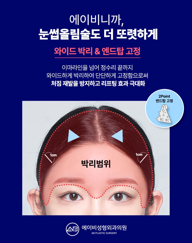 Curious About AB Plastic Surgery’s Brow Lift Surgery? image 5