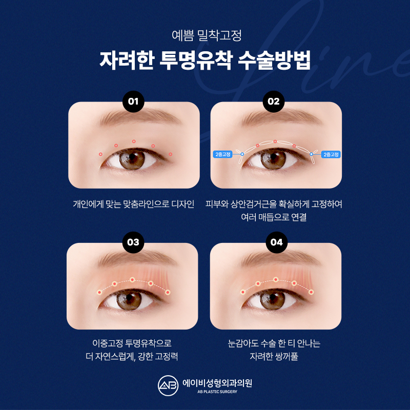If You Want Elegant Eyes, AB’s Elegant Transparent Adhesion image 9