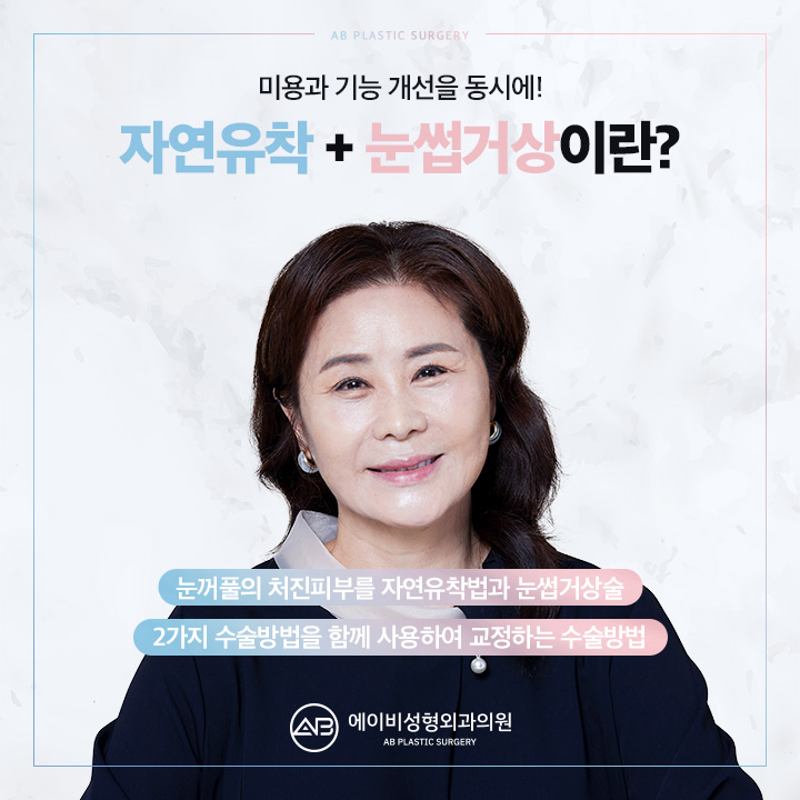 중년눈성형 에이비성형외과에서 차이를 느껴 관련 이미지 5