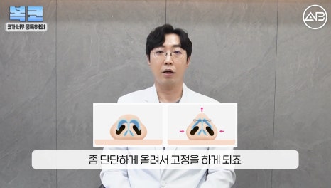#에이비성형외과#에이비tv#코성형#복코성형 관련 이미지 10