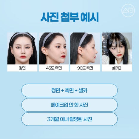 에이비성형외과 윤곽&middot;양악 모델모집 中 관련 이미지 5