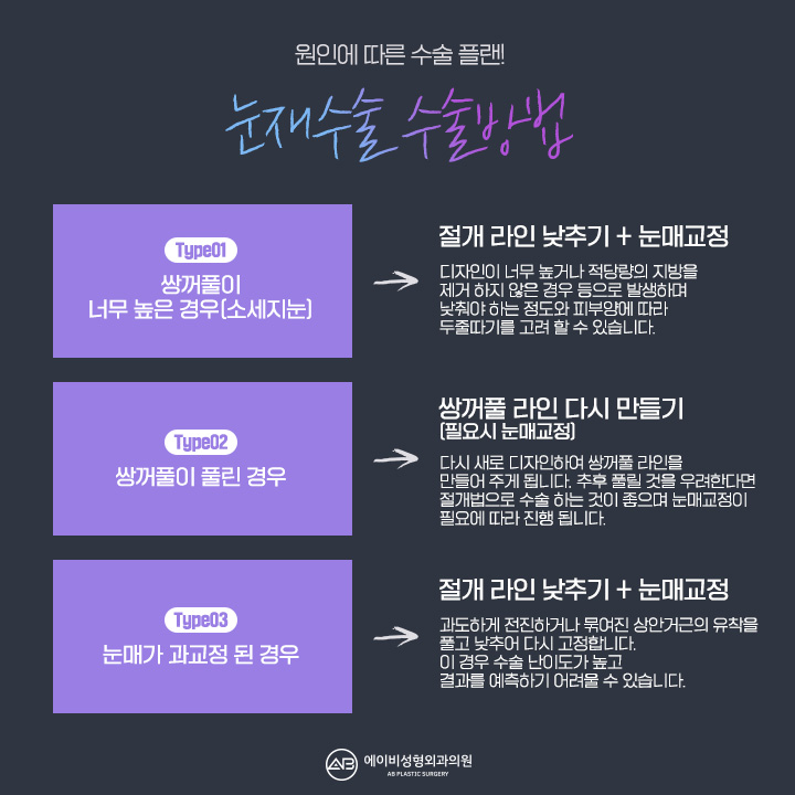 눈재수술비용 얼마인지 궁금해? 관련 이미지 3
