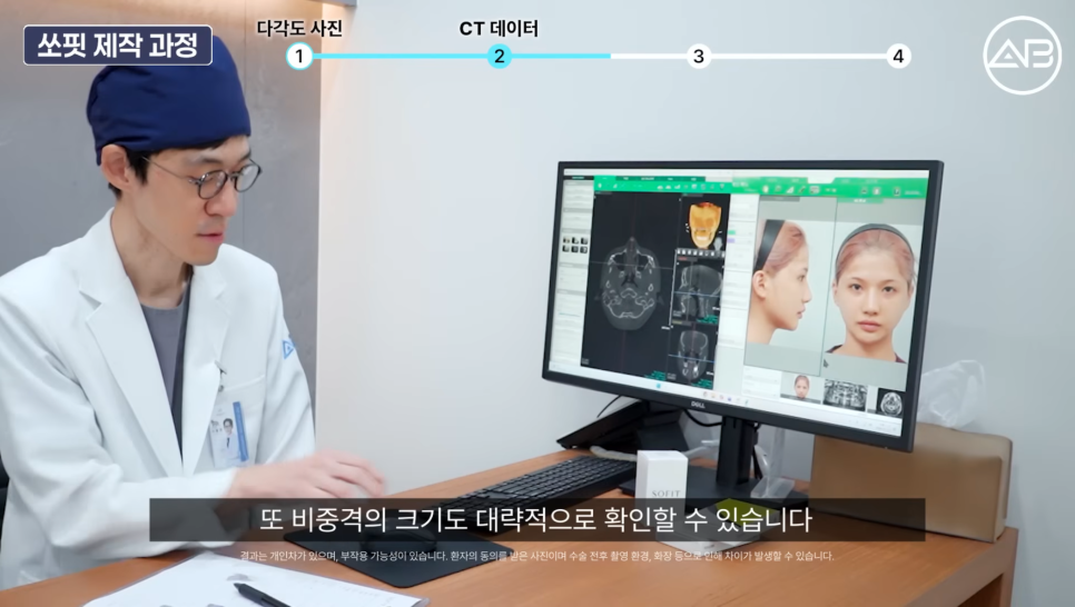 에이비성형외과 맞춤보형물 쏘핏 보형물이 중요한 이유 관련 이미지 3