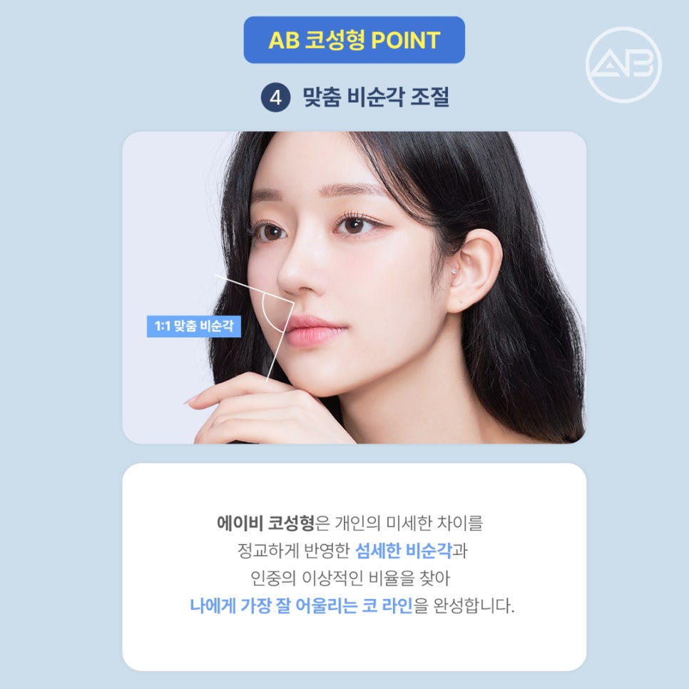 에이비성형외과 코끝처짐교정 원인부터 비주교정수술 비순각교정 핵심 정리 관련 이미지 5