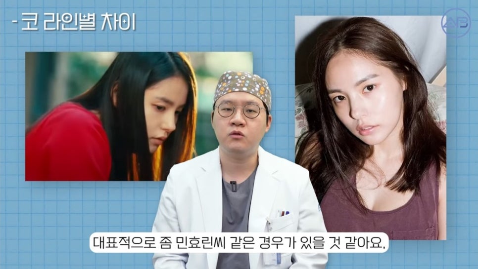 #에이비성형외과#에이비tv#코성형#코성형용어 관련 이미지 9