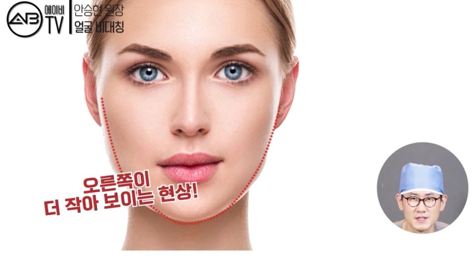 #에이비성형외과 #에이비TV #안면윤곽수술 #비대칭 관련 이미지 7