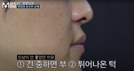 [에이비성형외과 방송출연] LG헬로비전&KBSjoy 관련 이미지 16