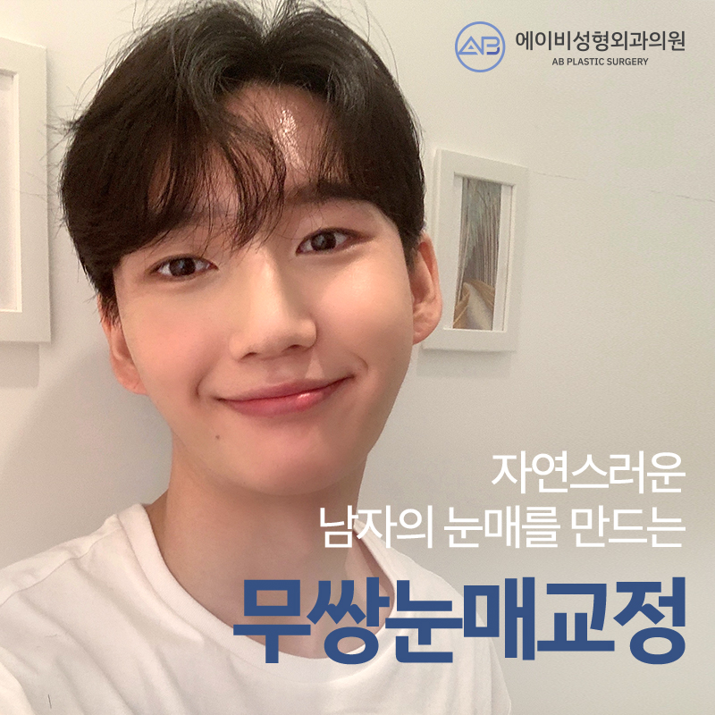 [칼럼] 쌍꺼풀 없이, 눈매교정만 할 수는 없나요? 관련 이미지 1