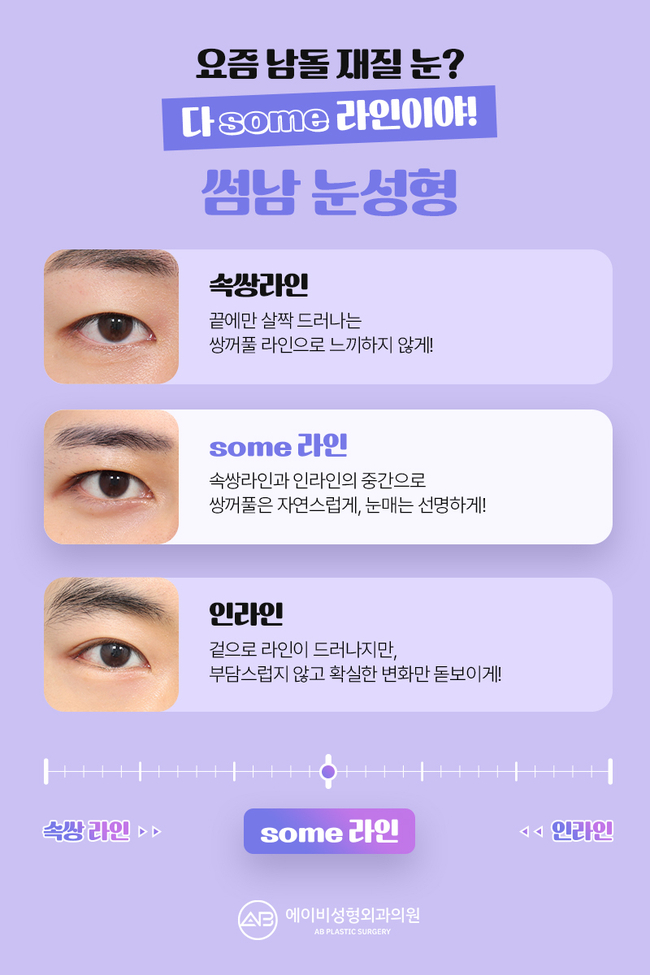 에이비성형외과 썸남눈성형 이게 뭔데? 관련 이미지 5