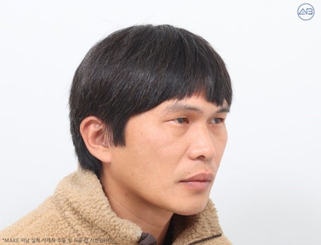 에이비성형외과 & 피부과 맥미남 (MAKE미남) 무국적내남자 관련 이미지 3