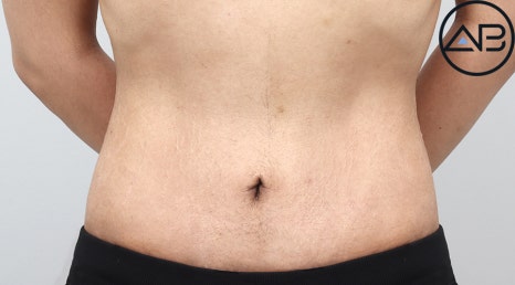 AB Plastic Surgery, MAKEmiNamn Broadcast Afterlife Update_방구석내남자 image 10