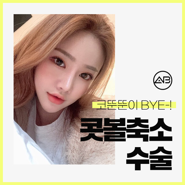 콧볼축소수술 코뚠뚠이의 해결책 관련 이미지 1