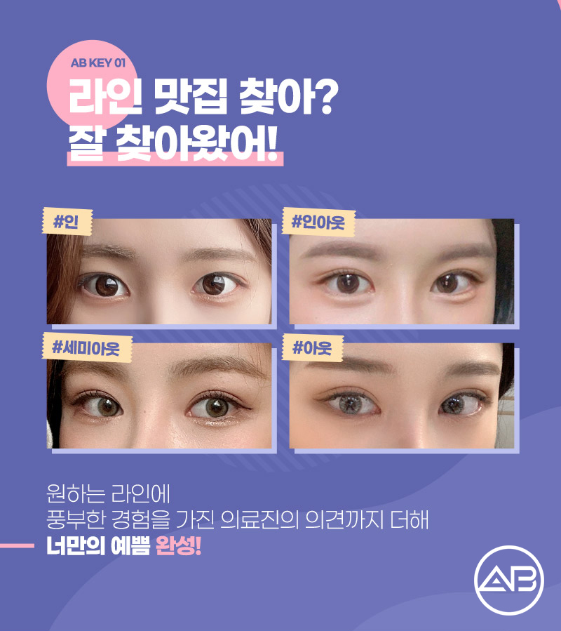 I Can Put Your Worries About Natural Adhesion Double Eyelid Swelling Aside image 3