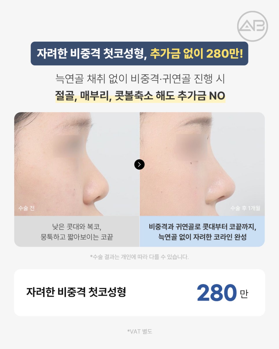 에이비성형외과 추석 기획전 눈밑, 비중격첫코, 윤곽 이벤트 관련 이미지 3
