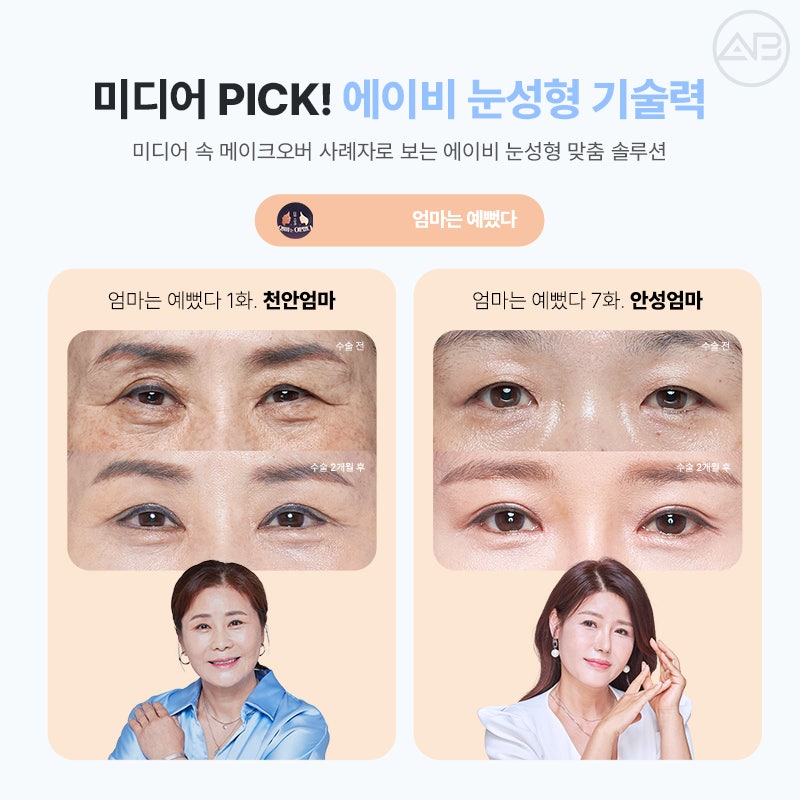Transparent Adhesion for a Refined Look: AB Plastic Surgery for Attractive Eyes image 13
