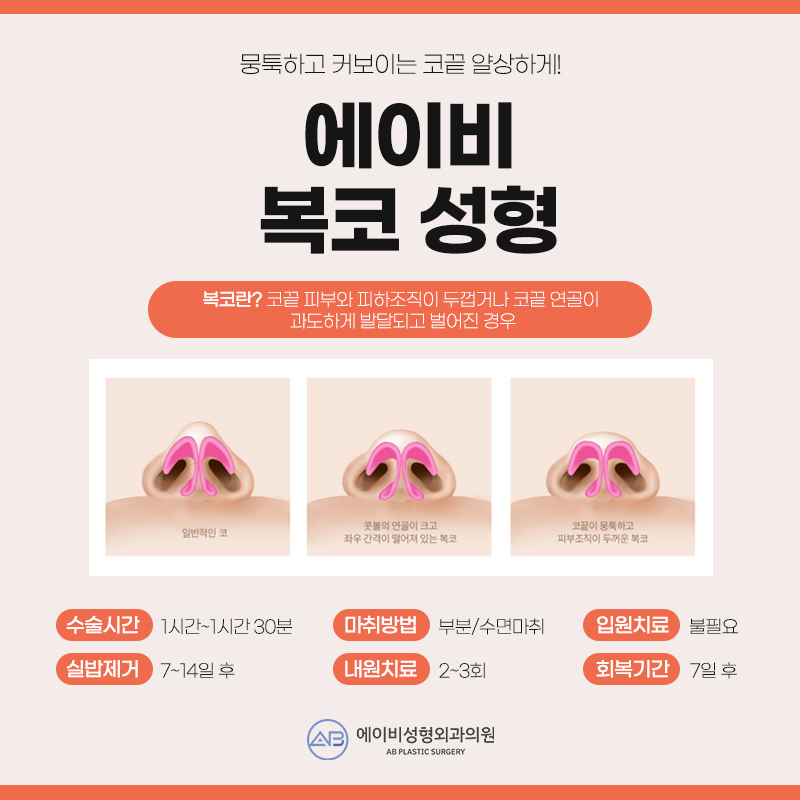 복코성형 이것만은 알고하자 관련 이미지 2