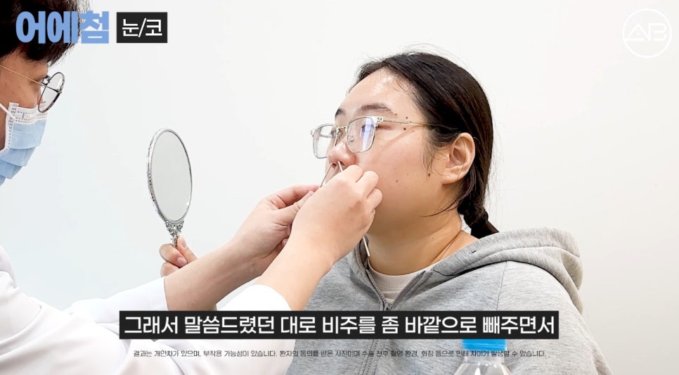 에이비성형외과 맥미걸(MAKEMEGirl) 맥미돌 코성형 상담 과정 관련 이미지 4