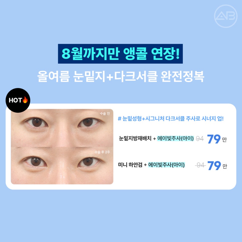 에이비성형외과 8월 여름 할인 이벤트 관련 이미지 2