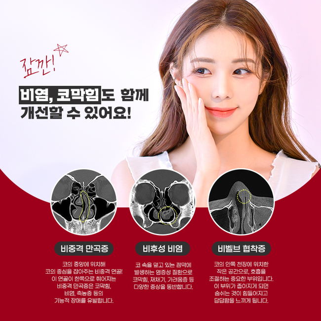 코수술후기 많은 에이비성형외과 관련 이미지 4