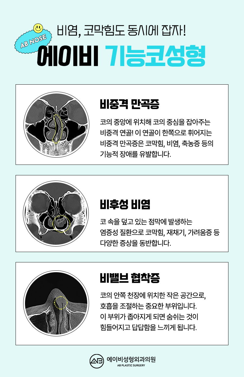 At AB Plastic Surgery, where there is extensive experience with autologous rib cartilage rhinoplasty image 7